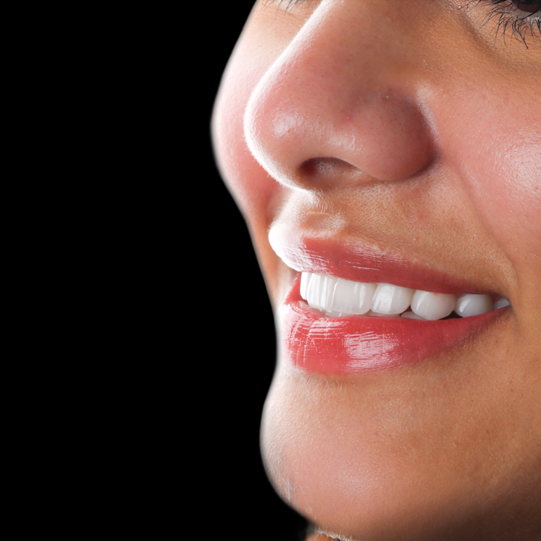 Smile Makeover Dubai Marina
